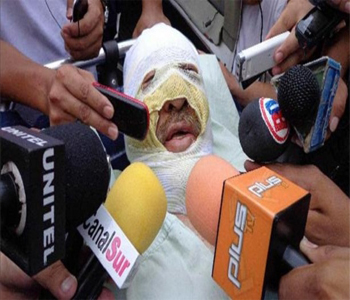 El periodista quemado en Bolivia acusa del ataque a un político local