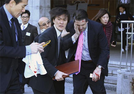Ataque al embajador de EEUU en Corea del Sur
