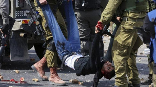 La represión israelí causa más de mil 250 heridos en Palestina