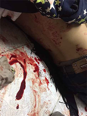 El régimen de Al Jalifa derrama la sangre de sus ciudadanos en Bahréin