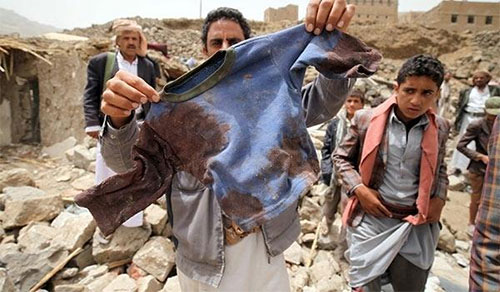 La agresión saudí mata a más niños en Yemen