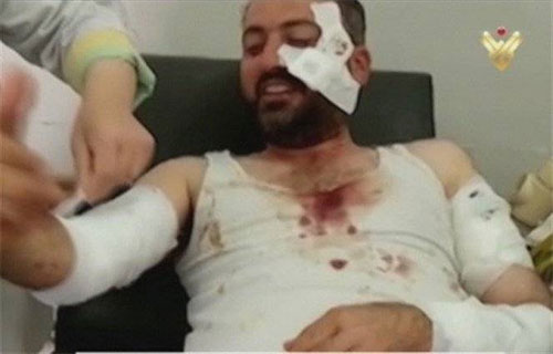 Dos cámaras y un reportero resultan heridos en el campo de Homs