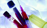 Nuevo m&eacute;todo para hacer 30 análisis de sangre con una sola gota
