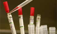 OMS: 2 enfermos de &eacute;bola en Liberia tratados con ZMapp muestran una clara mejoría