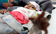 La situaci&oacute;n en Yemen se agrava entre la agresi&oacute;n saud&iacute; y el c&oacute;lera