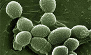 Una bacteria que habita en nuestro organismo puede producir electricidad 