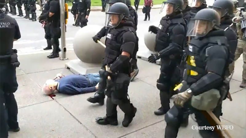Vergonzosa actuaci&oacute;n policial: agentes derriban a un anciano y lo dejan sangrando